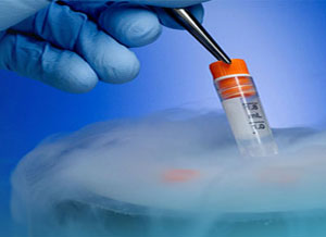 Embryo Cryopreservation