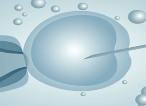ICSI Intracytoplasmic Sperm Injection